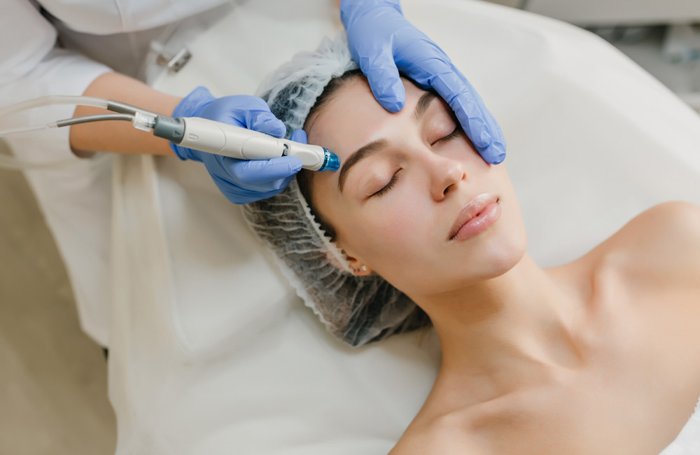 Tratamiento Dermapen